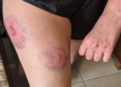 Suplente ao Senado é derrubada, chutada e atingida por bala de borracha pela PM em SC