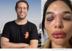 ULTRAJE E INDIGNAÇÃO: A JUSTIÇA ABRE AS PORTAS DA CADEIA E DEVOLVE ÀS RUAS O VIL AGRESSOR ACUSADO DE TORTURAR DENTISTA!