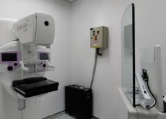 Hospital do Ipsemg volta a realizar exames de mamografia digital